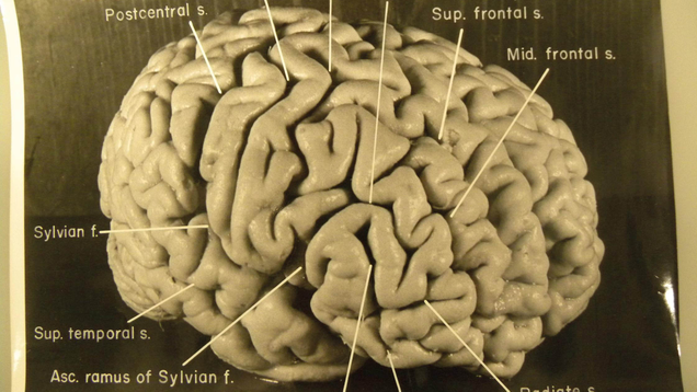 Illustration for article titled 5 Of Einstein’s Boldest Predictions About The Universe We Haven’t Yet Confirmed